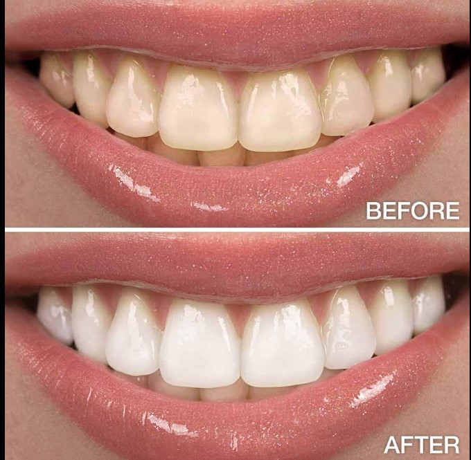 Dentifrice blanchissant liquide Colgate Max White Crystal Mint - Image 2