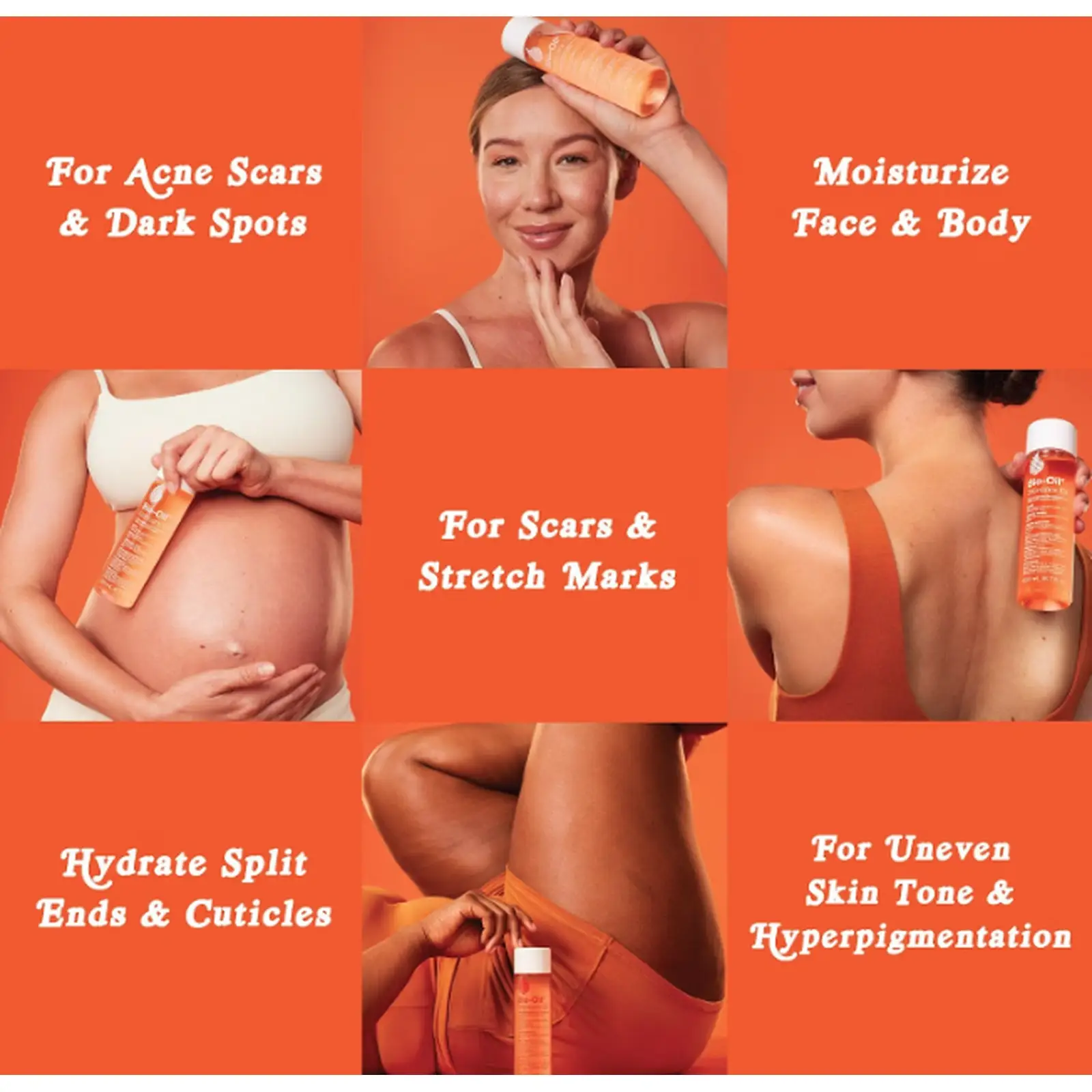 Bio-Oil Huile de soin pour cicatrices et vergetures, soin hydratant visage et corps à la vitamine E et A pour peaux sèches et sensibles, recommandé par les dermatologues, non comédogène, 125 ml - Image 2